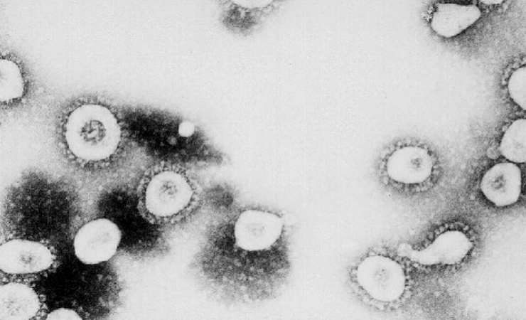 Coronavirus Moderna