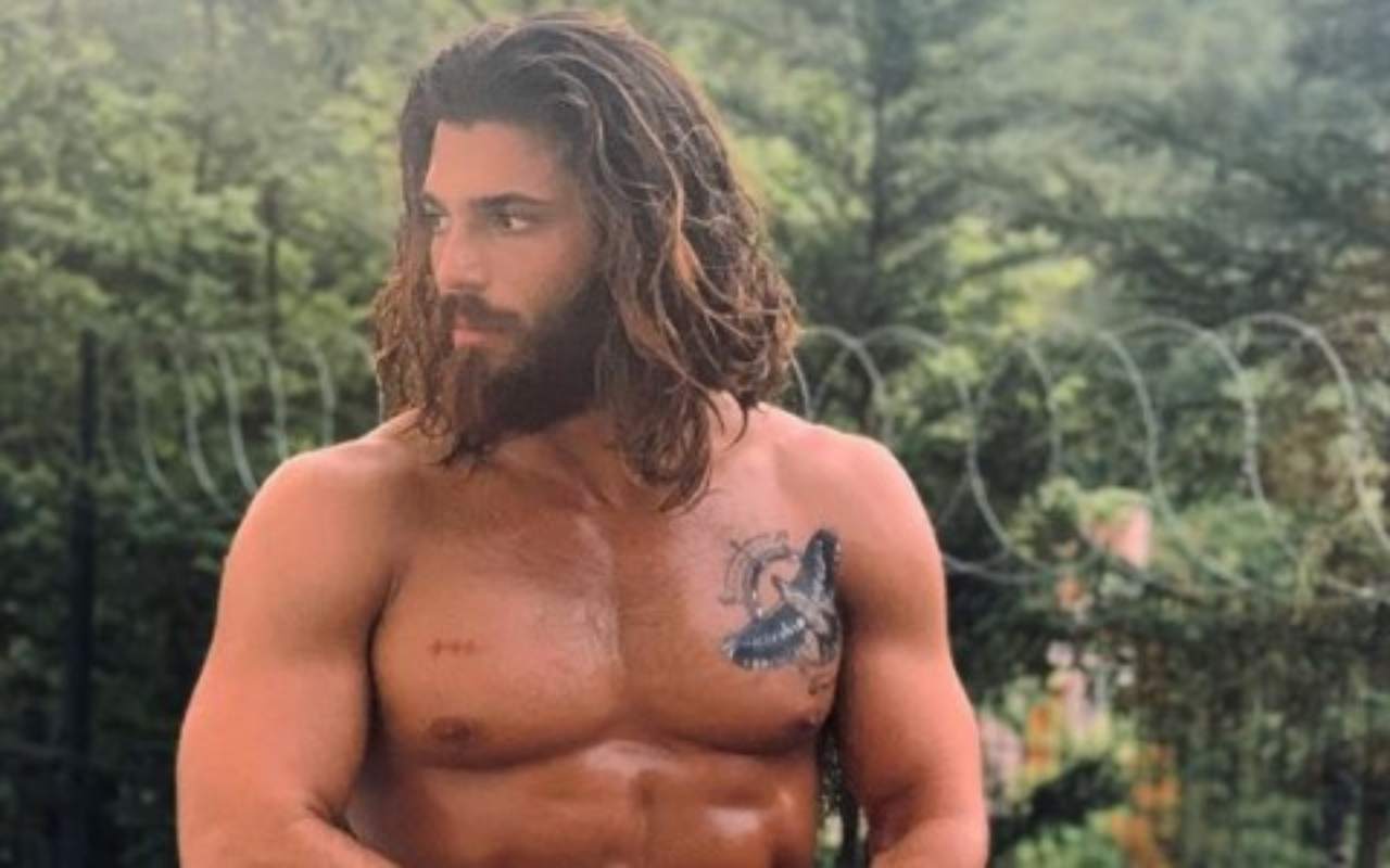 Can Yaman braccio fasciato