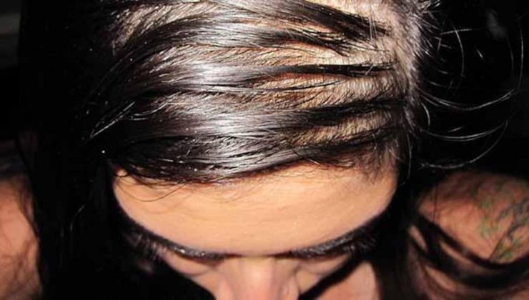 capelli-unti-Altranotizia
