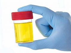 urine-quando-il-colore-può-far-preoccupare-Altranotizia