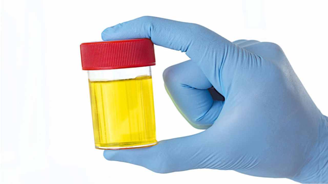 urine-quando-il-colore-può-far-preoccupare-Altranotizia