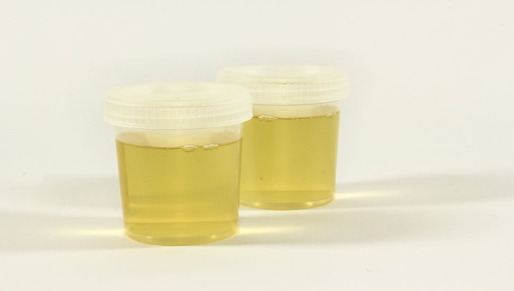 urine-Altranotizia