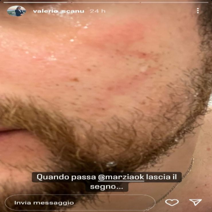 Valerio-Scanu-Instagram-Story-07062022-Altranotizia