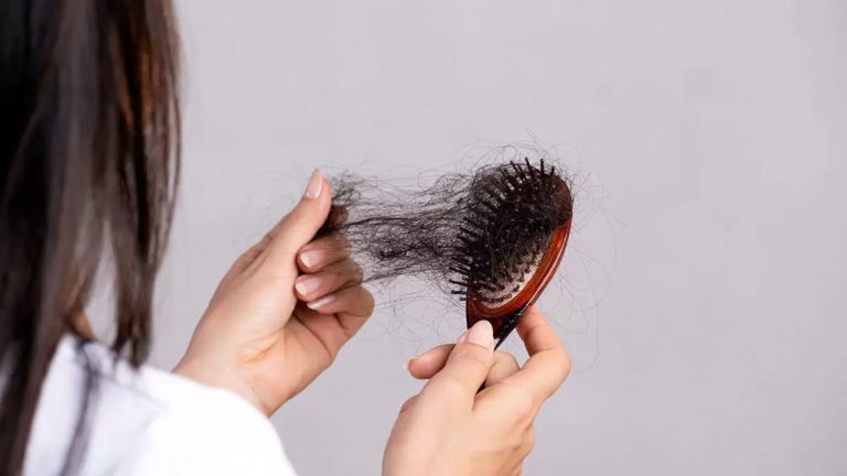 101 COSE DA DIRE QUANDO STAI PERDENDO I CAPELLI I visual data 3